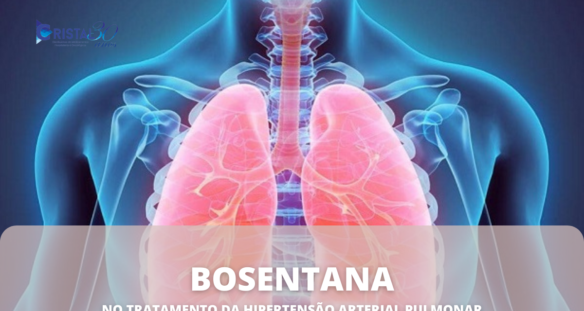 Para que serve o remédio Bosentana, valor e onde comprar?